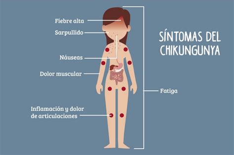 Chikungunya síntomas tratamiento prevención y estadísticas