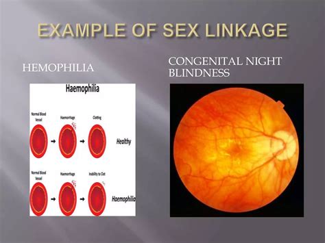 Sex Linkage Ppt