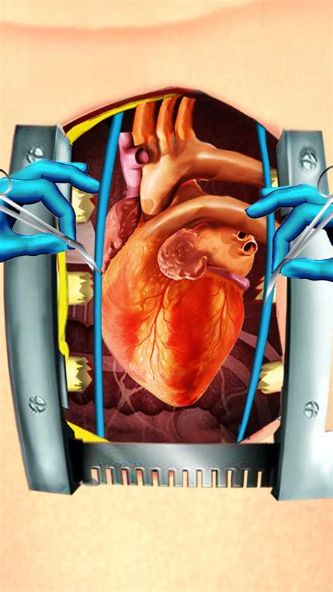 Open Heart Surgery Simulator Apk For Android Download