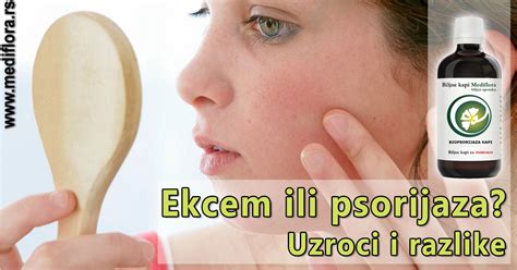 Ekcem Ili Psorijaza Uzroci I Razlike Mediflora