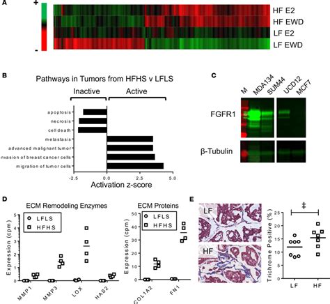 Obesity Promotes Endocrine Therapy Resistance Phenotype After EWD A