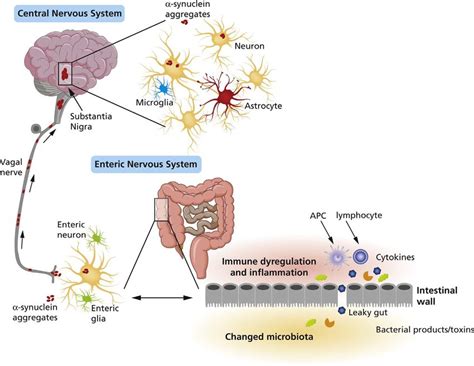 A Schematic Representation Of Alpha Synuclein Accumulation And