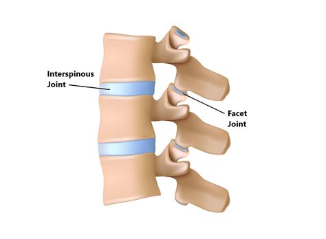 Facet Joint Injuries - My Family Physio