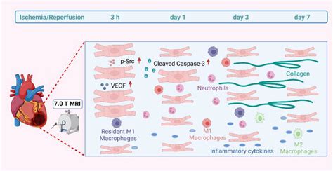 Frontiers Characterization Of Early Myocardial Inflammation In Ischemia Reperfusion Injury