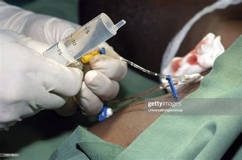 Central Venous Catheter Insertion The Surgeon Prepares To Flush The