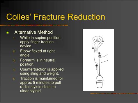 Ppt Dislocation And Fracture Reductions Powerpoint Presentation Free