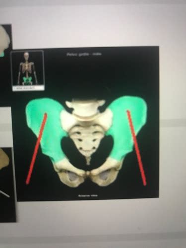 Lab Pelvic Girdle And Femur Osteology Flashcards Quizlet