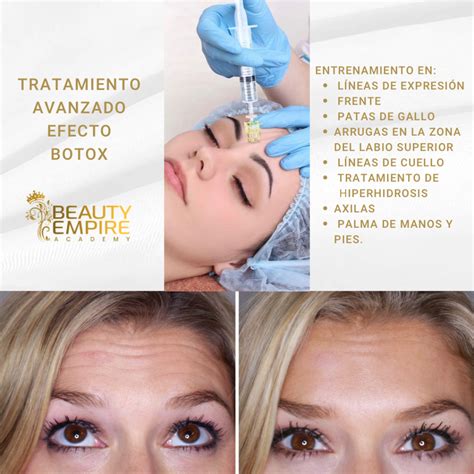 Armonización Facial y Meso Bótox Estético Beauty Empire Academy