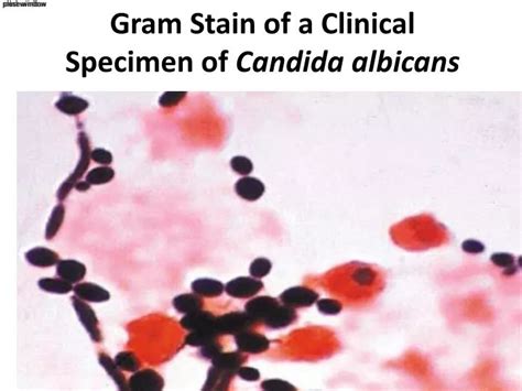 Candida Albicans Microscope Slide