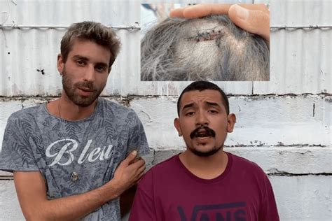 Padova Coppia Gay Aggredita Da Persone Per Un Bacio Punti Di Sutura In Testa VIDEO Gay It