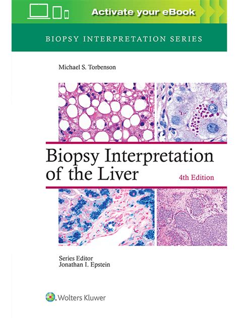 Biopsy Interpretation Of The Liver 4th Edition Vasiliadis Medical Books