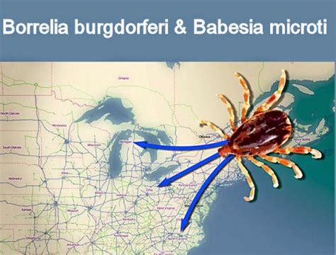 Medical Laboratory And Biomedical Science Lyme Disease Enhances Spread Of Babesiosis