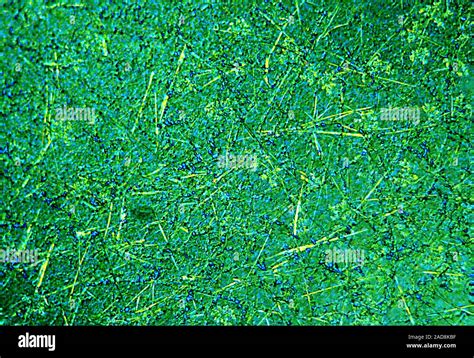 Mushrooms And Bacteria Destroy Emulsion Film Under The Microscope 100x