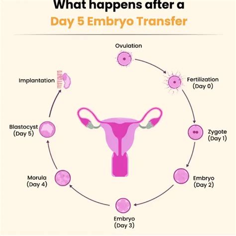 What Happens Day-by-Day After an Embryo Transfer - Nua Fertility