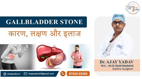 Gall Bladder Stones Symptoms And Complications Youtube