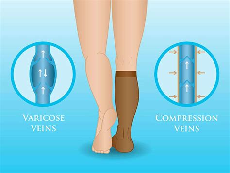 Compression Therapy Novus Spine And Pain Center Lakeland Florida