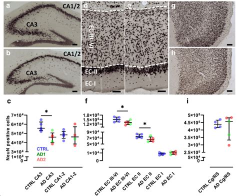 Neuronal Loss In Alzheimer Inoculated Mouse Lemurs Neun Staining Of