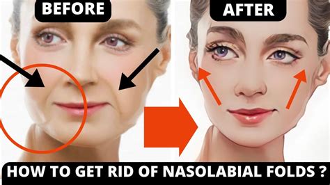 21 Min Facial Exercises For Nasolabial Folds Laugh Lines Lift Smile