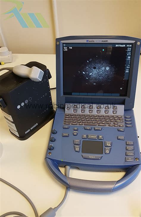 SonoSite P17 5 1 Cardiac Sector Robin Medical Ltd