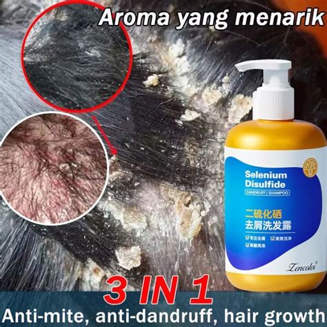 Anti Dandruff Shampoo 300ml Selenium Disulfide Dandruff Syampu Rambut