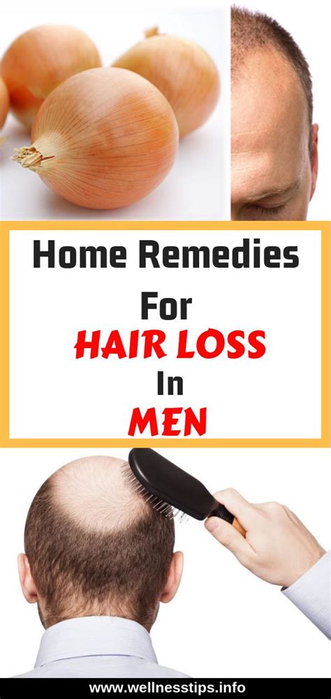 Home Remedies For Hair Loss In Men Hair Hairloss Haircare Homeremedies Naturalremedie