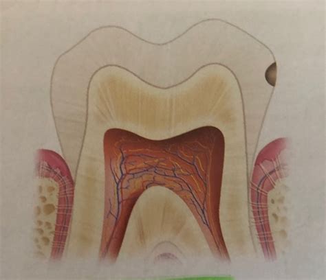 282 Ch 33 Interpretation Of Dental Caries Flashcards Quizlet