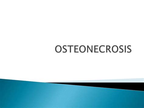 Osteonecrosis Ppt