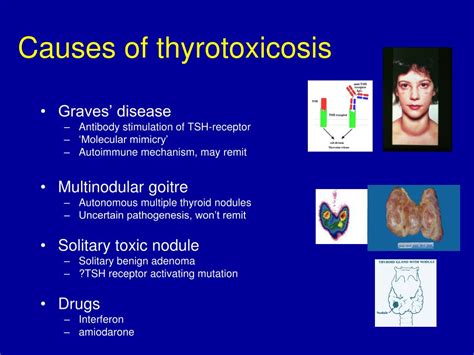 Ppt Thyroid Disease Powerpoint Presentation Free Download Id1147073