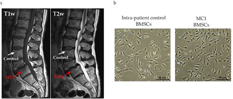 Pdf Fgf2 Overrides Key Pro Fibrotic Features Of Bone Marrow Stromal