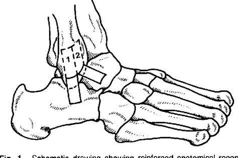 Figure 1 From Reinforced Anatomical Reconstruction Of The Anterior