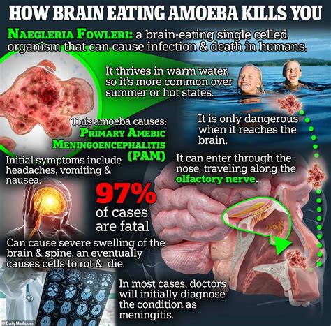 Fl Boy Becomes Only Fifth American To Survive Brain Eating Bug