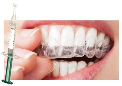 Opiniones Dentales Blog Dental Irriak