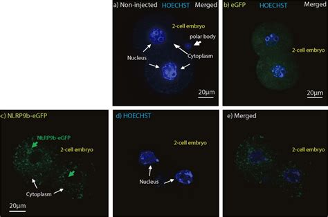 Intracellular Distribution Of NLRP9B EGFP In 2 Cell Mouse Embryos