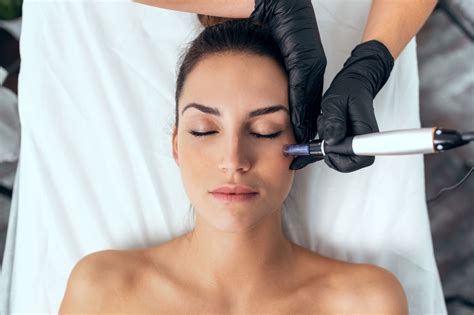 Microneedling Liège Comment Obtenir Une Peau Radieuse Et Rajeunie