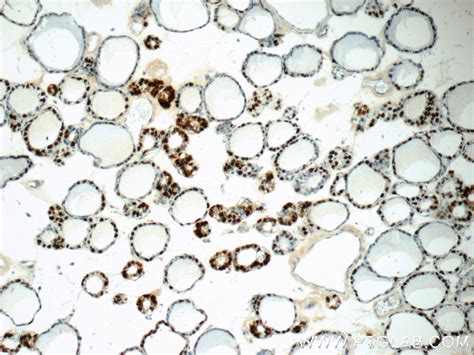 S100A13 antibody 14987 1 AP Proteintech 武汉三鹰生物技术有限公司