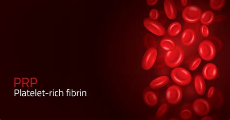 Platelet Rich Fibrin Does It Have A Future In Implant Dentistry Gp