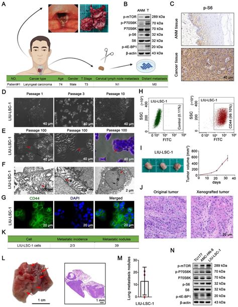 Establishment And Characterization Of A Novel Lscc Cell Line