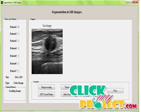 Prostate Segmentation In Mr Images Using Discriminant Boundary Features