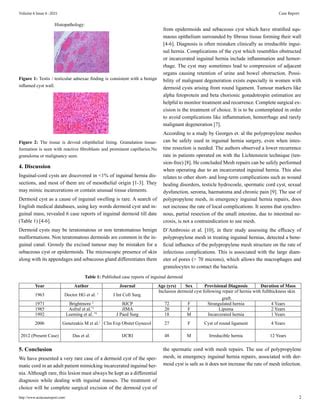 Dermoid Cyst of the Spermatic Cord Mimicking Incarcerated Inguinal Hernia | PDF