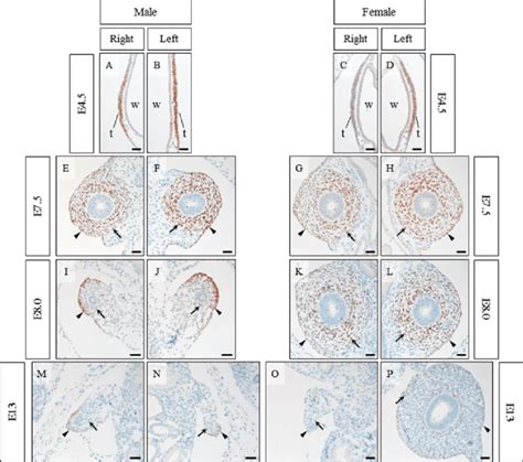 Doublesex And Mab Related Transcription Factor Dmrt Localization