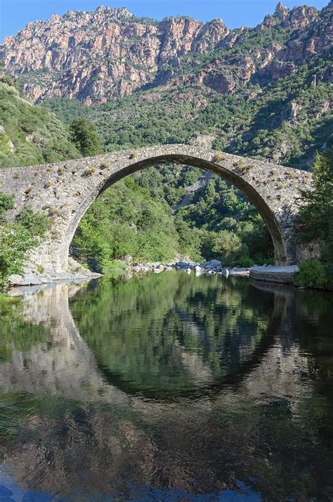 Para Qué Sirven Los Arcos En Ortodoncia Ortodoncia Junin