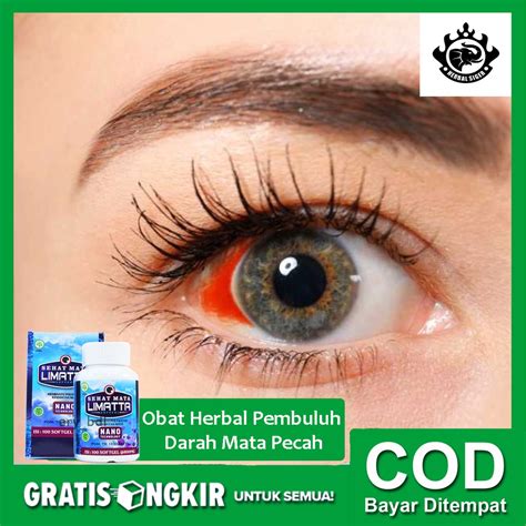 Jual Obat Herbal Pembuluh Darah Mata Pecah Mata Merah Sehat Mata