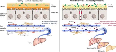 The Gut Liver Axis In Liver Disease Pathophysiological Basis For Therapy Journal Of Hepatology