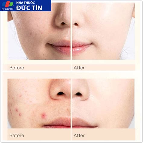 Kem Nền Che Khuyết Điểm Nude Air QUYÊN LARA Làm Trắng Da Thu Nhỏ Lỗ Chân Lông Phù Hợp Cho Da Dầu