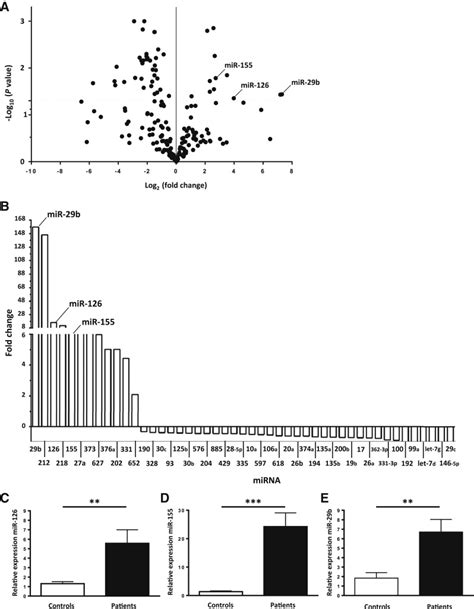 Association Of Elevated Urinary Mir 126 Mir 155 And Mir 29b With