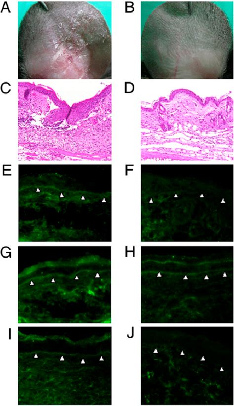 Igg Purified From Diseased Mice Induces Dermal Epidermal Separation