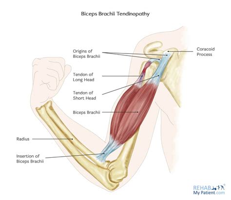 tendon - DriverLayer Search Engine