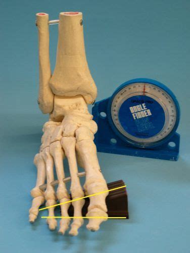 Foot Biomechanics Part 1 Root Theory Hersco Edu Center