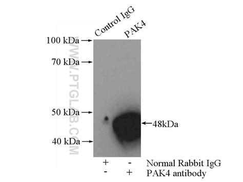 pak antibody   ap proteintech