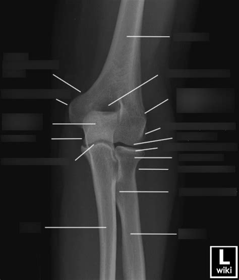 AP Elbow Diagram Diagram Quizlet